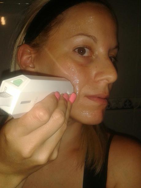 Radiofrecuencia facial, con Tripollar Stop