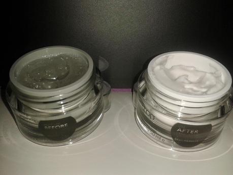 Radiofrecuencia facial, con Tripollar Stop