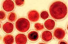 asxant5 Carotenoides: betacaroteno y astaxantina: antioxidantes para la piel y salud