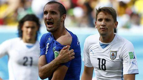 Chiellini mostrando el mordisco de Luis Suárez luis suárez Nueve partidos son pocos el nacional com