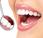 Estética dental cost… ¡Cuidado!