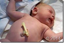 Cordon-umbilical-bebe-recien-nacido