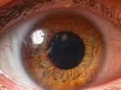 Regeneración Corneal Celulas Madres