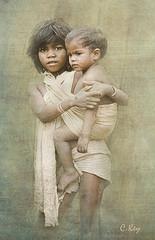 Ceguera en niños de países en desarrollo Ceguera en niños de países en desarrollo