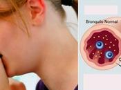 Como aliviar bronquitis asma