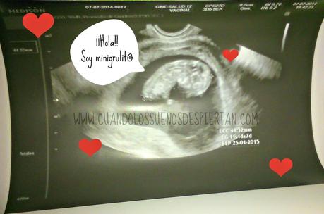 ¿ QUE LE PASA A LA GRULA?