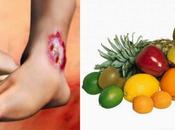 Frutas diabeticos deben evitar