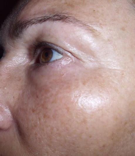 dermo cosmetica pierre fabre