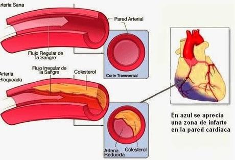 LOS 5 ALIMENTOS MAS SALUDABLES