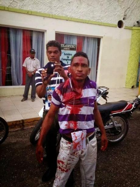 Un herido en Barahona en votación PRD.