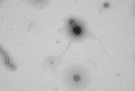 virus al microscopio