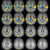 NeuroMarketing: ¡Ya sé cómo piensas!