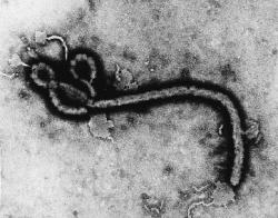 ebola virus 250x196 Qué es el Ébola?