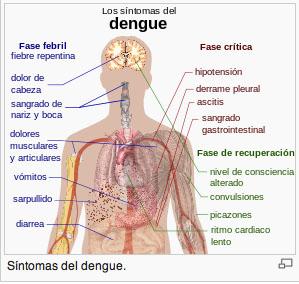 sintomasdengue