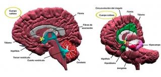 El Cuerpo Calloso