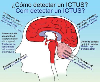 Los Accidentes Cerebrovasculares: Ictus y Derrame Cerebral (I)