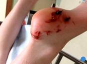 ¿Ataque tiburón lago?