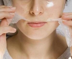 10 Tratamientos para las arrugas en la piel