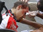 Contusiones cicloturistas