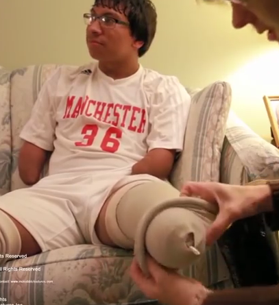 Jugar al fútbol sin pies ni manos !es posible!