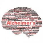 Alzheimer-Brain
