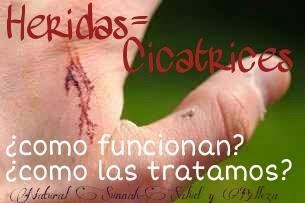 Cicatrices y Heridas-¿como funcionan y como las tratamos?