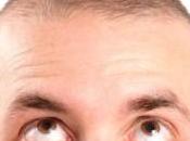 Consejos para cura Calvicie