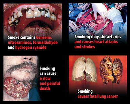 Tenga cuidado de cigarrillos es la causa de cáncer de pulmón