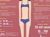¿Qué anorexia? #Infografía #Salud #Anorexia