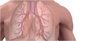 6 Problemas extra-articulares de la Artritis Reumatoide artricenter