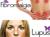 Lupus Fibromialgia: similitudes diferencias