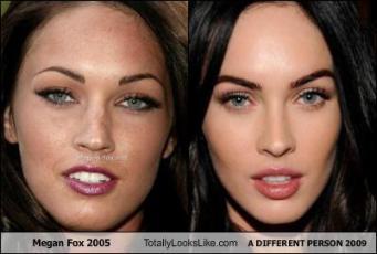 BICHECTOMIA, LA SOLUCIÓN PARA AFINAR TU ROSTRO 129145985885625797