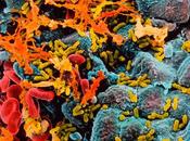 cistitis vista microscopio