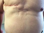 cáncer femenino, masculino