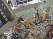 EEUU están preocupados brote enterovirus causa infecciones respiratorias graves niños