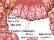 Alimentos Estimulan Enfermedad Crohn