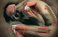 Población económicamente activa: la más afectada por enfermedades reumáticas