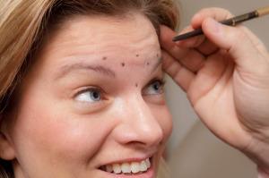 botox-in-forehead