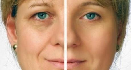 COMO DISIMULAR LAS OJERAS