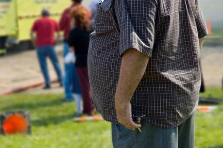 Tratamiento de la Obesidad. Relación entre Obesidad y Alzheimer