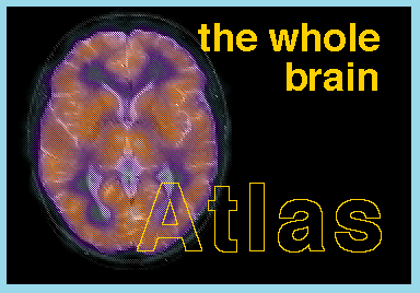 Imágenes de un cerebro real en vivo
