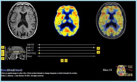 Imágenes de un cerebro real en vivo