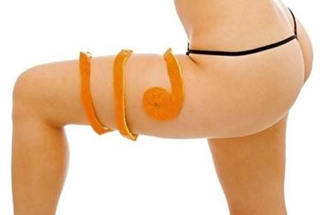 como evitar la celulitis