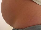 Nivel tiroxina embarazo rendimiento matemáticas niños