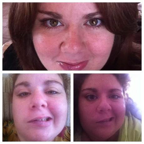 Sobreviví al Bells Palsy