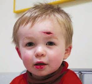 #33 premio relato corto sobre enfermedades raras: Cambios