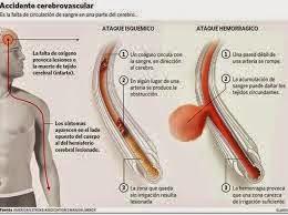 Perfecciona la imágen del diagnóstico
