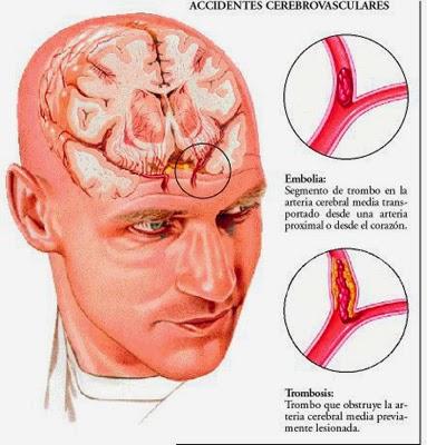 Perfecciona la imágen del diagnóstico