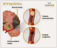 Perfecciona la imágen del diagnóstico