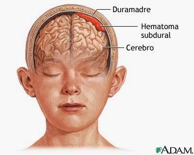 Perfecciona la imágen del diagnóstico